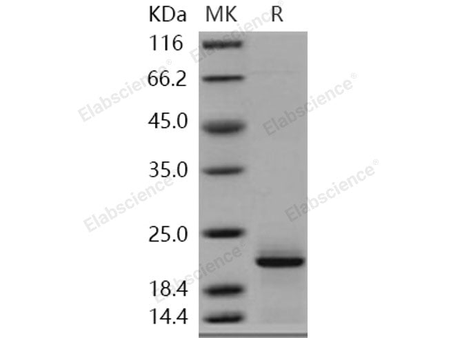 Recombinant Human Complexin-2/CPLX2 Protein (His Tag)