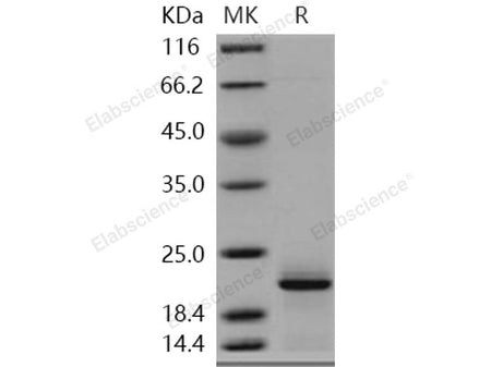 Recombinant Human Complexin-2/CPLX2 Protein (His Tag)