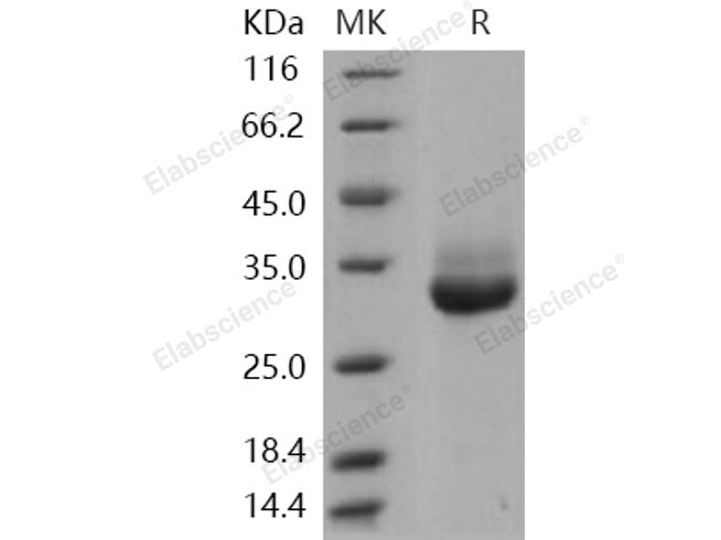 Recombinant Human Kallikrein 4/KLK4 Protein (His Tag)(Active)