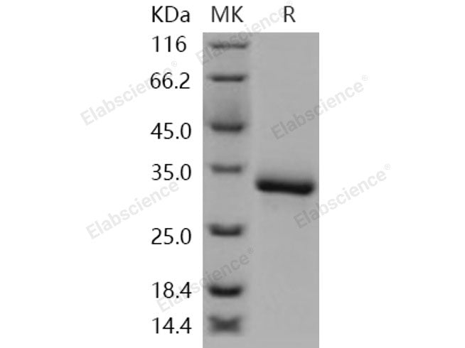 Recombinant Human XEDAR/EDA2R Protein (His Tag)