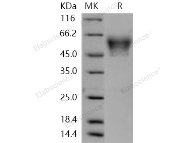Recombinant Human NRXN3 Protein (His Tag)(Active)