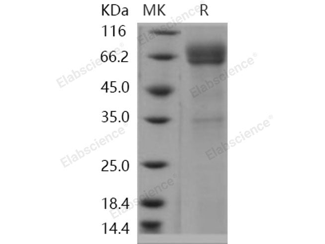 Recombinant Human CD1B/CD1A Protein (Fc Tag)