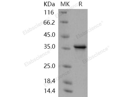 Recombinant Human TWF1/Twinfilin-1 Protein
