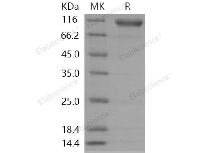 Recombinant Human Semaphorin 4D/SEMA4D Protein (His Tag)(Active)