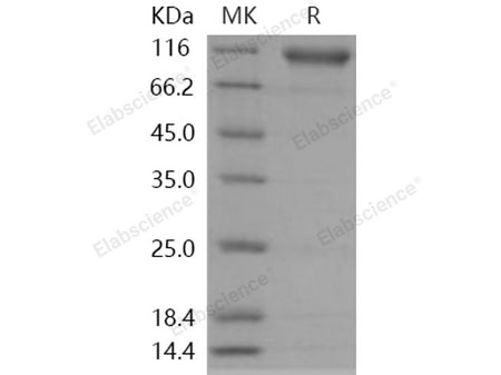 Recombinant Human Semaphorin 4D/SEMA4D Protein (His Tag)(Active)