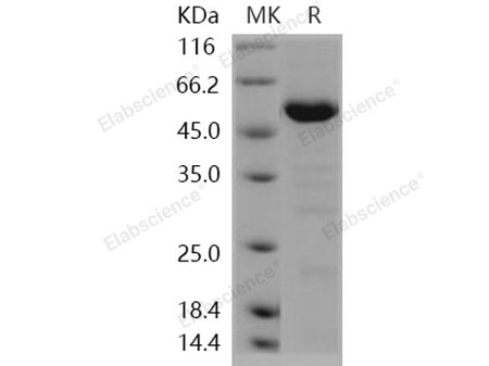 Recombinant Human HDAC4 Protein (aa 612-1084)