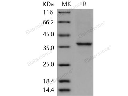 Recombinant Human COL2A1 Protein (aa 1242-1487, His Tag)