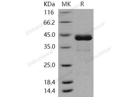 Recombinant Human CALML5/CLSP Protein (His & GST Tag)