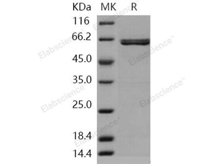 Recombinant Human AIM2 Protein (GST Tag)(Active)
