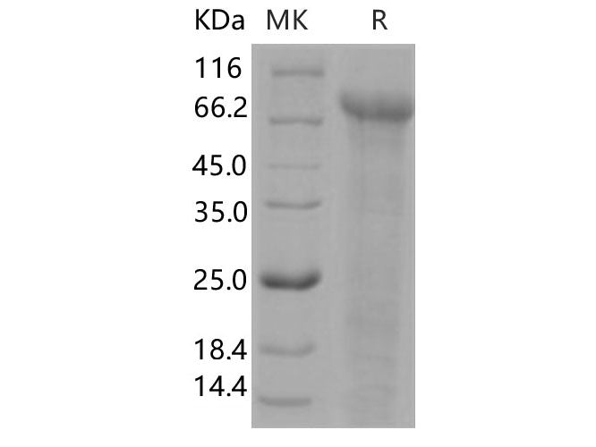 Recombinant Human Jagged 1/JAG1 Protein (His Tag)(Active)