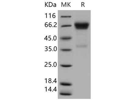 Recombinant Human OLFM4 Protein (His Tag)