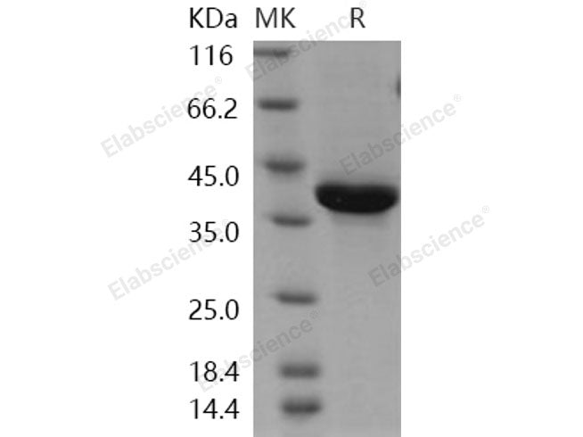 Recombinant Human Neuregulin-1/NRG1-β1 Protein (EGF Domain, Fc Tag)(Active)