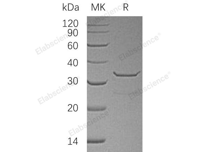 Recombinant Human SULT1B1 Protein (His Tag)(Active)
