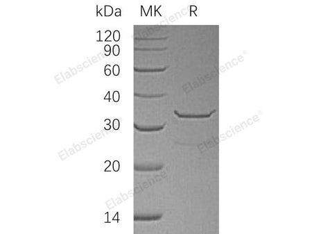 Recombinant Human SULT1B1 Protein (His Tag)(Active)