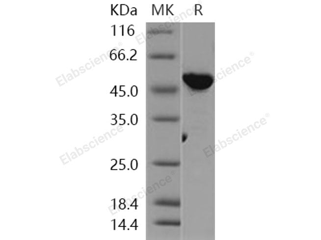 Recombinant Human VRK1 Protein