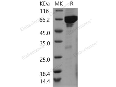 Recombinant Human VRK1 Protein (His & GST Tag)