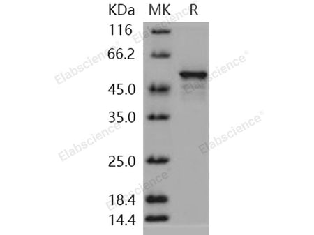 Recombinant Human DOT1L/KMT4 Protein