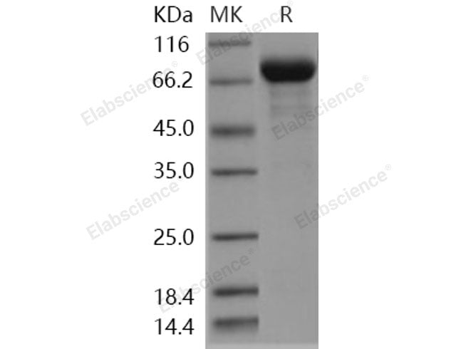 Recombinant Human ENPP5 Protein (His Tag)