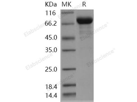 Recombinant Human ENPP5 Protein (His Tag)