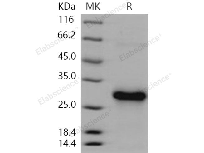 Recombinant Human CLEC4A/DCIR Protein (His Tag)