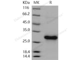 Recombinant Human CLEC4A/DCIR Protein (His Tag)