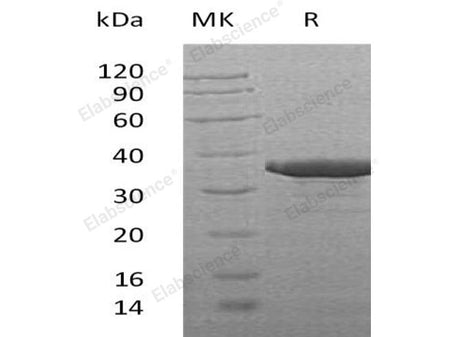 Recombinant Human SULT2B1 Protein (aa 2-365, His Tag)