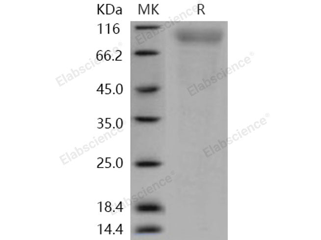 Recombinant Human CD180/RP105/LY64 Protein (His Tag)(Active)