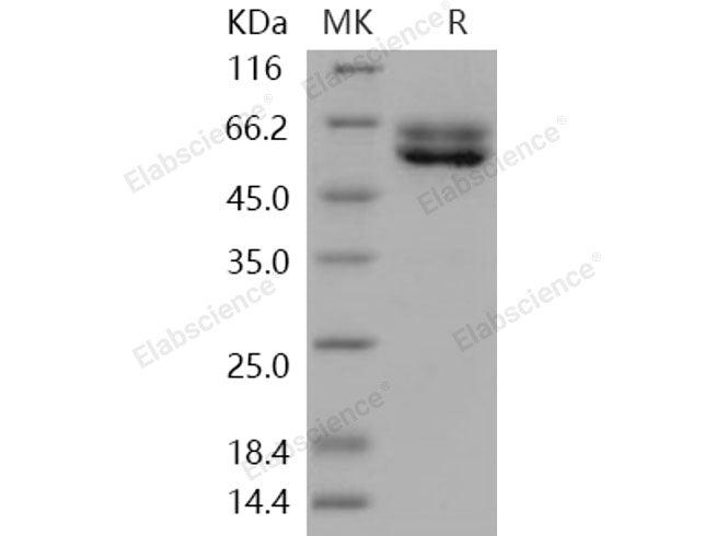 Recombinant Human FUT10/Fucosyltransferase 10 Protein (His Tag)