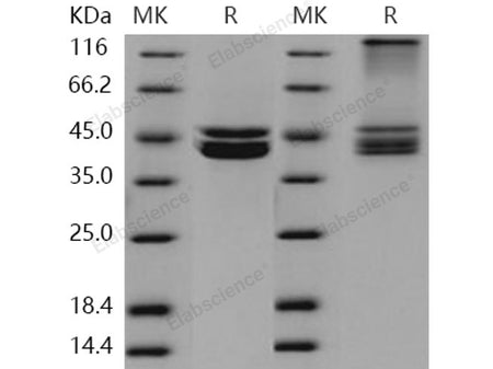 Recombinant Human PRMT6/HRMT1L6 Protein (His & FLAG Tag)