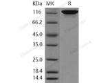 Recombinant Human Autotaxin/ENPP2 Protein (aa 49-863, His Tag)