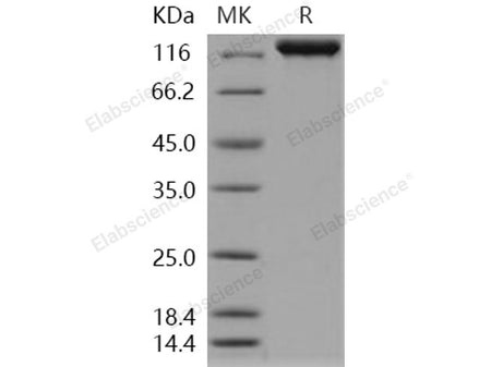 Recombinant Human IGSF3/EWI-3 Protein (His Tag)