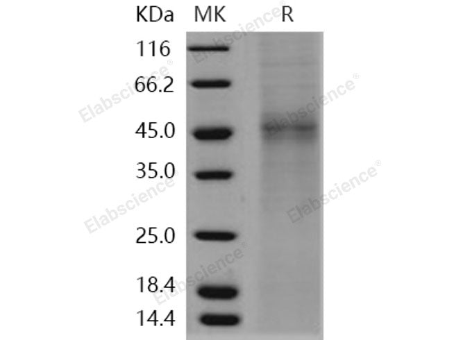 Recombinant Human TPST1 Protein (His Tag)