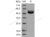 Recombinant Human Carboxypeptidase M/CPM Protein (His Tag)(Active)