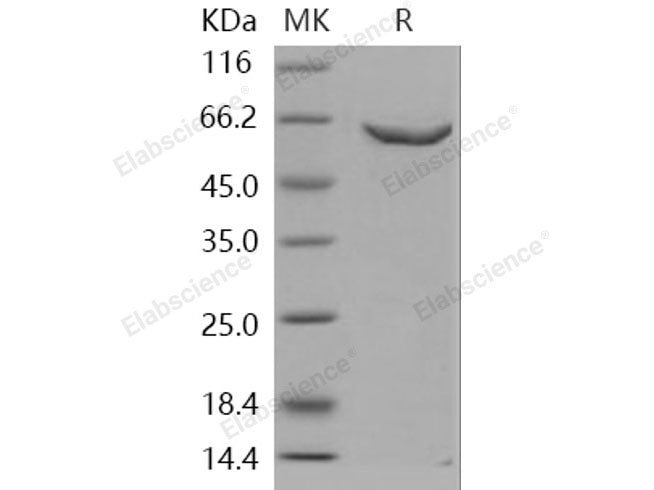 Recombinant Human DNMT2/TRDMT1 Protein (GST Tag)