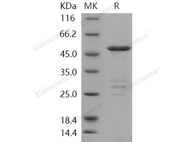 Recombinant Human METTL11A Protein (GST Tag) - MSE Supplies LLC