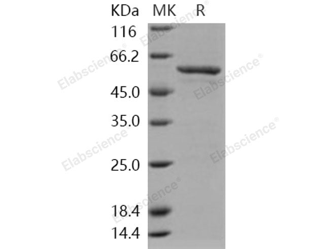 Recombinant Human SMYD3/ZMYND1 Protein (GST Tag)