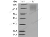Recombinant Human LAMP1/CD107a Protein (His Tag)(Active) - MSE Supplies LLC