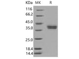 Recombinant Human CADM3 Protein (His Tag)(Active)