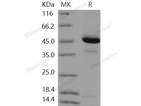 Recombinant Human REG4/RELP Protein (Fc Tag)