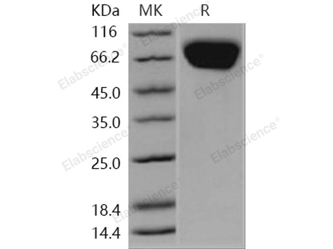 Recombinant Human FLRT3 Protein (His Tag)(Active)