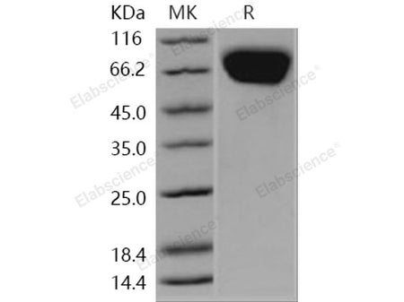 Recombinant Human FLRT3 Protein (His Tag)(Active)
