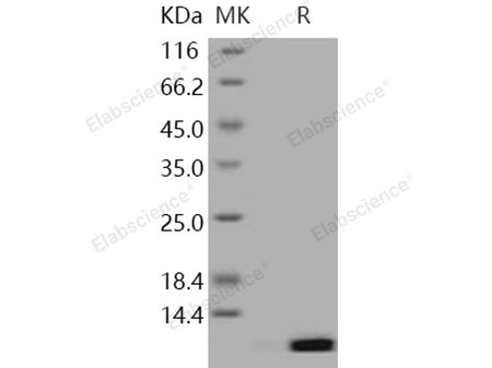 Recombinant Human S100A12/CAGC Protein (Active)