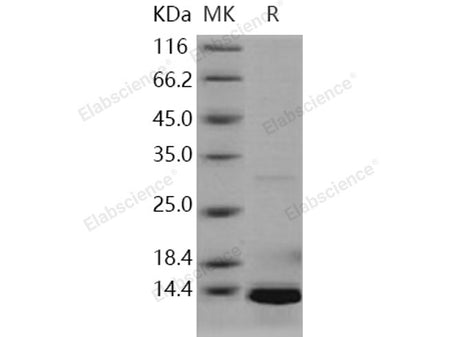 Recombinant Human S100A5 Protein (His Tag)