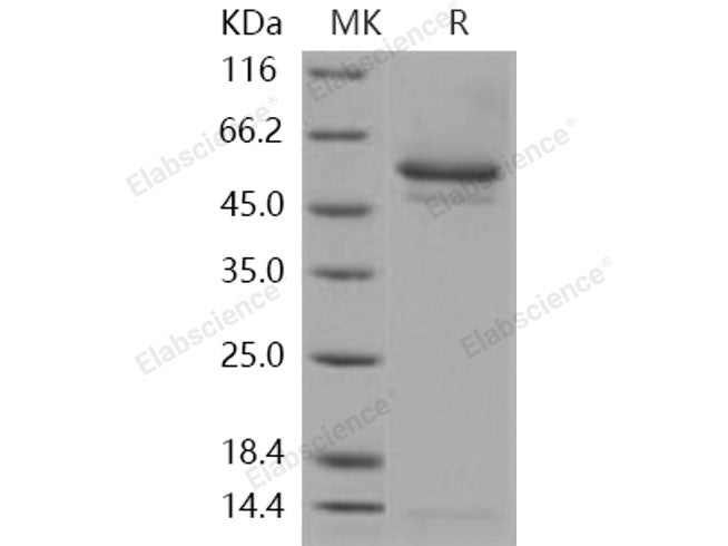 Recombinant Human SerpinI1/Neuroserpin Protein (His Tag)