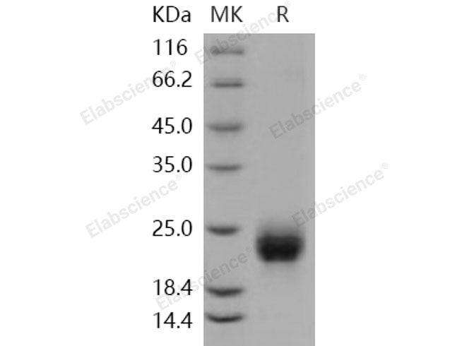 Recombinant Human R-Spondin 1/RSPO1 Protein (aa 1-146, His Tag)(Active)