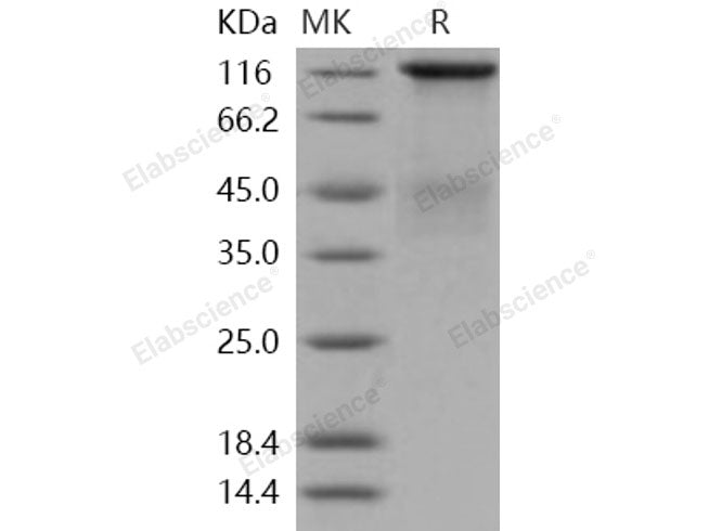 Recombinant Human Insulin Receptor/INSR Protein (long isoform, His Tag)(Active)