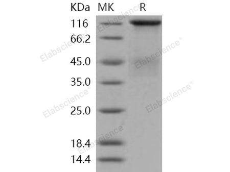 Recombinant Human Insulin Receptor/INSR Protein (long isoform, His Tag)(Active)