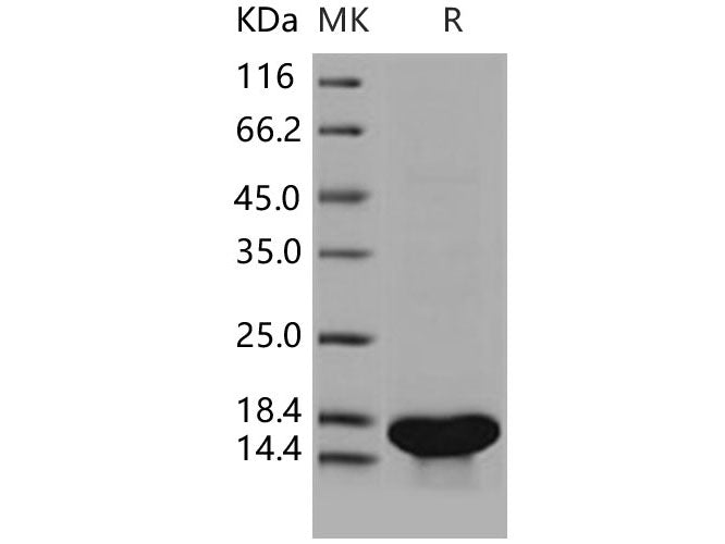 Recombinant Human TrkA/NTRK1 Protein (aa 285-413, His Tag)