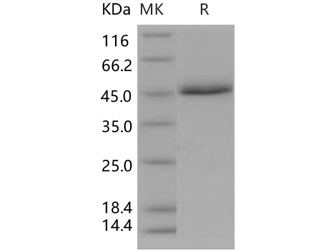 Recombinant Human CD5 Protein (His Tag)(Active)