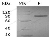 Recombinant Human Transferrin Protein (His Tag)(Active)
